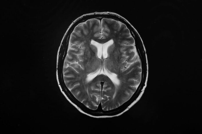 cbrain